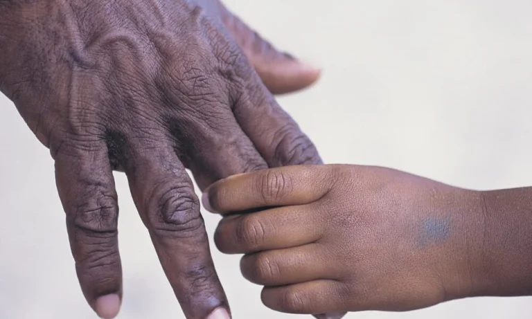 INSS paga pensão especial a filhos de vítimas de feminicídio desde hoje